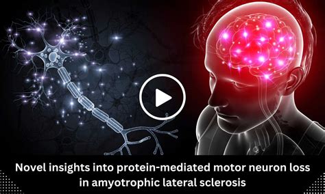 Novel insights into protein-mediated motor neuron loss in amyotrophic ...