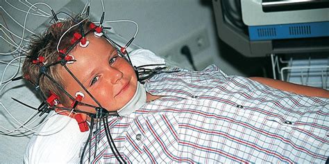 Elektroencephalographie (EEG) und Video-EEG – Neurologie.Psychiatrie ...
