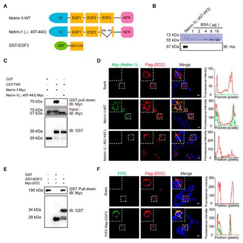 A Novel Netrin-1-Derived Peptide Enhances Protection against Neuronal ...