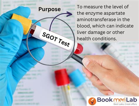 SGOT Test: Price, Purpose, Normal Range, Results & Risks