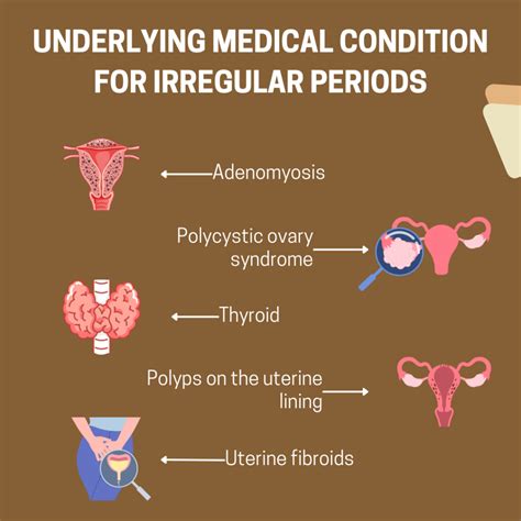 Understanding the 10 Causes of Irregular Periods: A Comprehensive Guide