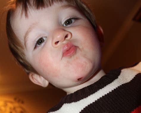 Image result for Boo Boo Hurt