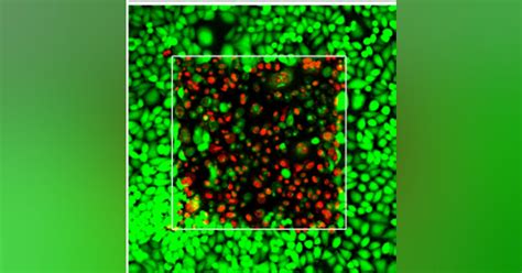 11th Harmonic Cancer 的图像结果