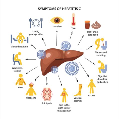Hepatitis C Symptoms And Signs