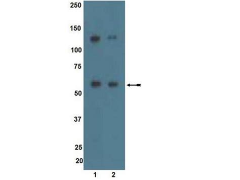 Anti-ALK7 Antibody | 09-158