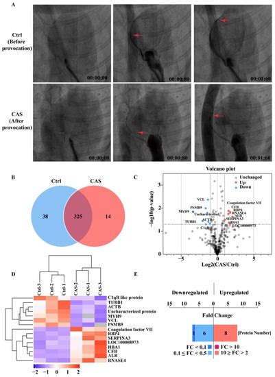 Serum SELENBP1 and VCL Are Effective Biomarkers for Clinical and ...
