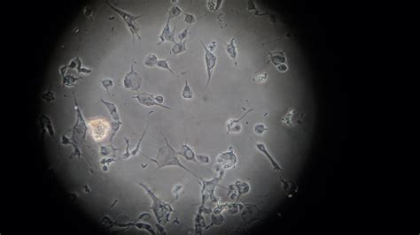 How to distinguish dead C3H10T1/2 cells and healthy cells under microscope?