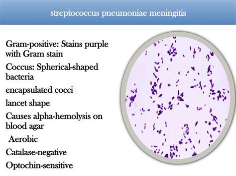 Streptococcus pneumoniae for laboratory students .pptx