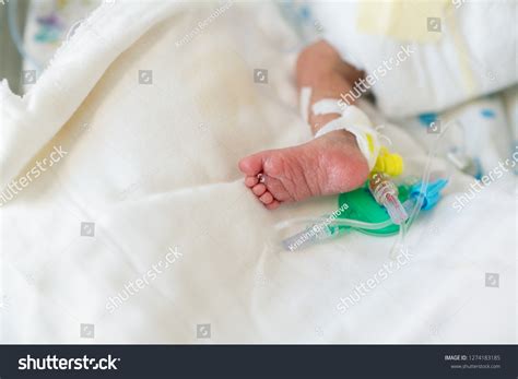 255 Neonatal Pulse Oximeter Images, Stock Photos & Vectors | Shutterstock