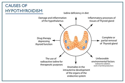 علائم، علل و درمان کم کاری تیروئید