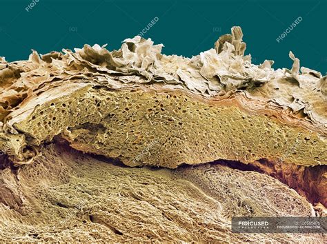 Scanning Electron Micrograph 的图像结果