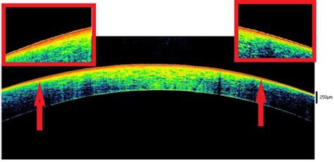 The Influence of Eyelid Position and Environmental Conditions on the ...