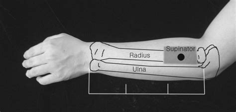 Image result for Contralateral Forearm