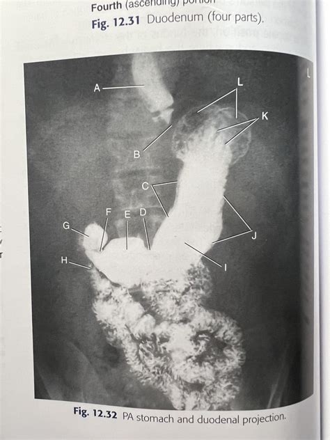 Image result for Duodenum vs Jejunum