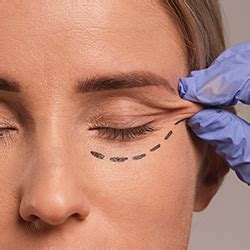 Dermal Fillers – Youthful Volume & Contour | Wizderm