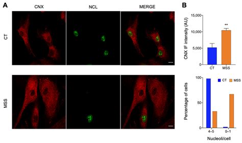 Proteomic Analysis of Marinesco–Sjogren Syndrome Fibroblasts Indicates ...