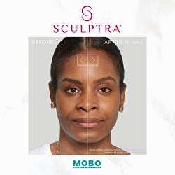 Option Oracle 的图像结果