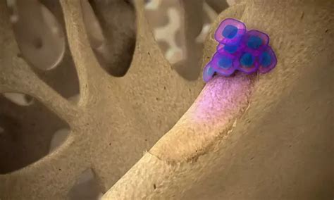 Injection of GIP and GLP-2 may reduce bone resorption biomarker CTX in ...