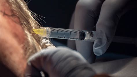 Image result for Mutilation Excision