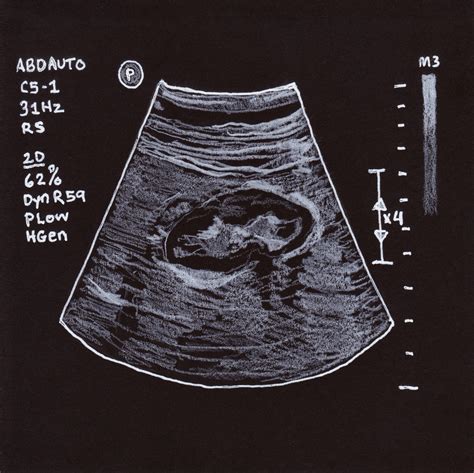 Image result for Alien Ultrasound
