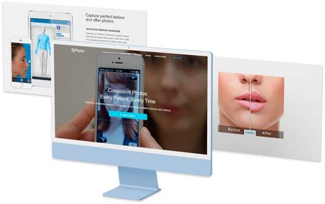 Medical Encoder Software 的图像结果