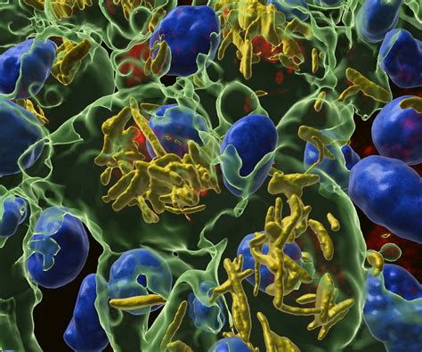 Join the Imaris Workshop Day at Fresnel Institute Facility! – France-BioImaging