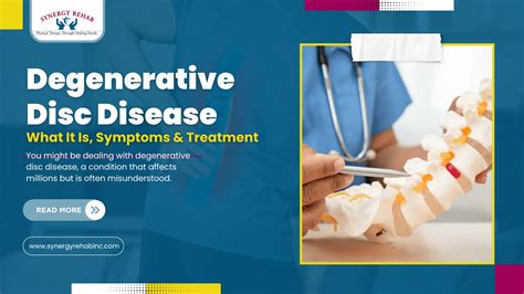 Degenerative Disc Disease: Symptoms & Treatments - Expert Insights