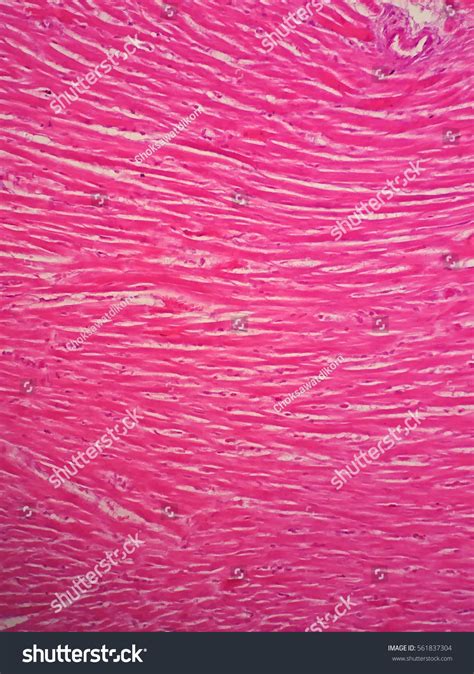 Histology Human Cardiac Muscle Under Microscope Stock Photo 561837304 ...