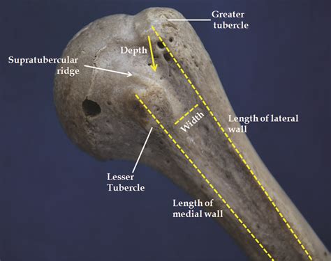 Medial Bicipital Groove