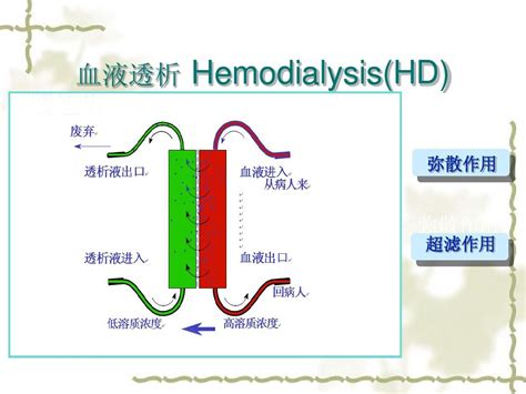 CRRT Recirculation 的图像结果