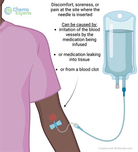 Infusion Site Pain | ChemoExperts
