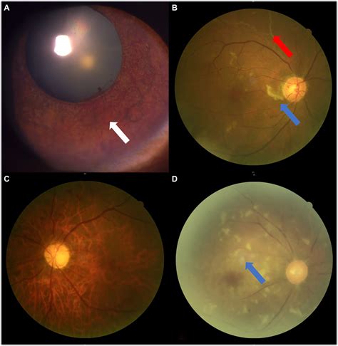 Frontiers | Morphological and functional abnormalities of ophthalmic ...
