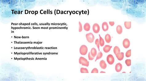 PERIPHERAL BLOOD SMEAR (STAINING, CELLS AND CONDITIONS) | PPTX