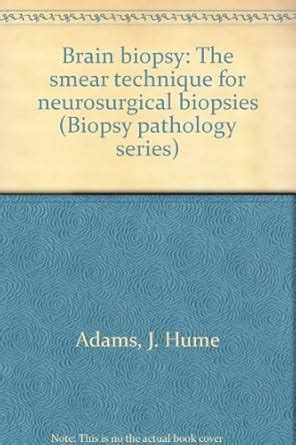 Buy Title: Brain biopsy The smear technique for neurosurgical Book ...