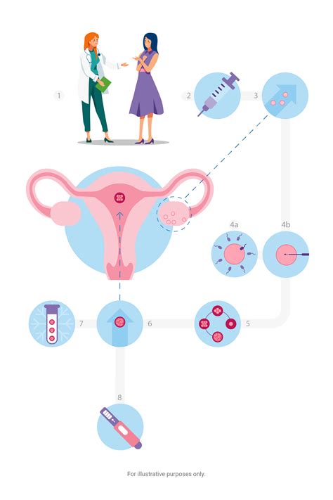 IVF Process Step by Step 的图像结果