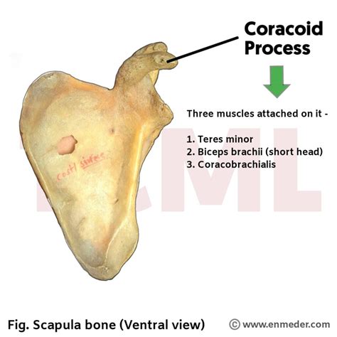 Coronoid Process