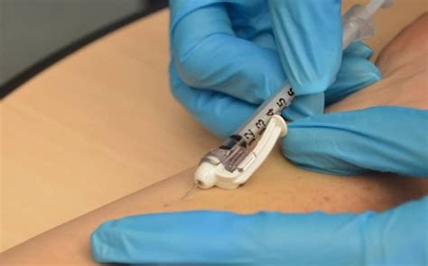 इंट्रावेनस इंजेक्शन (Intravenous Injection) का इस्तेमाल, साइड इफेक्ट ...