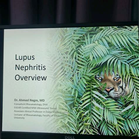 My next presentation: Future Lupologists (SLE specialists) are invited to this panoramic view of ...