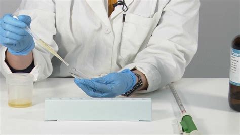 Determinación de proteínas en la orina-Prueba del anillo de Heller - TV Universidad de Murcia