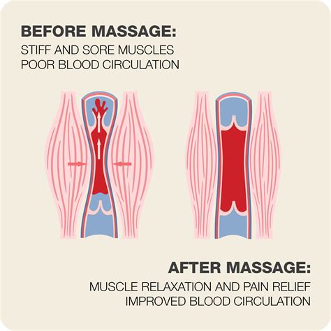 Massage Pain Afterwards
