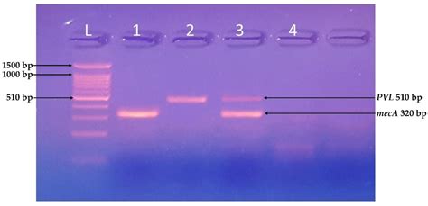 Frequency and Molecular Characterization of Staphylococcus aureus from ...
