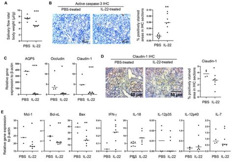Interleukin-22 Exerts Detrimental Effects on Salivary Gland Integrity ...