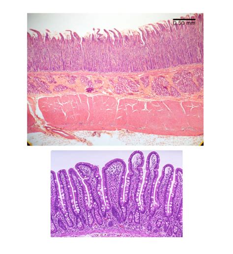 Duodenum Definition 的图像结果