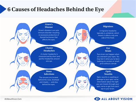 Headache Location Meaning: Behind the Eyes, Side of Head & More