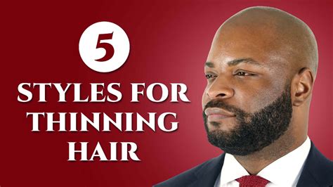 Thinning Hair Black Male
