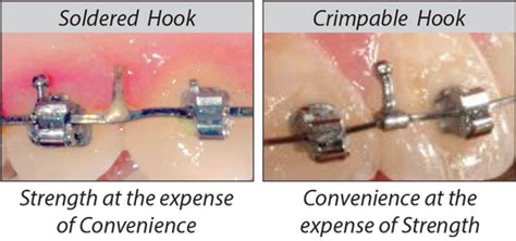Unbranded Orthodontics Orthodontic Arch Wire J&J Orthodontic Crimpable ...