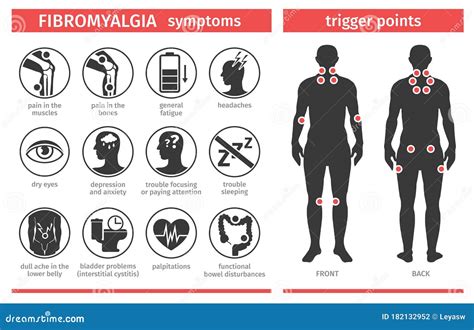 Symptoms and Signs of Fibromyalgia. Tender Points. Infographic ...