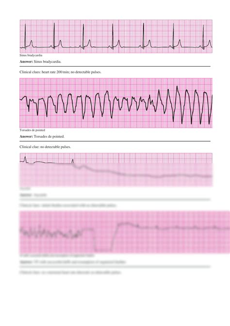 SOLUTION: Pals precourse self assessment answers rhythm - Studypool