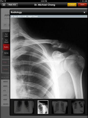 Image result for Allscripts Gateway