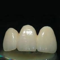 SM Dental Labs